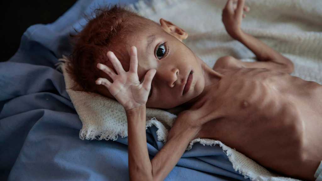 Saudi War on Yemen Killed 3,6k+ Children, Paralyzed 800
