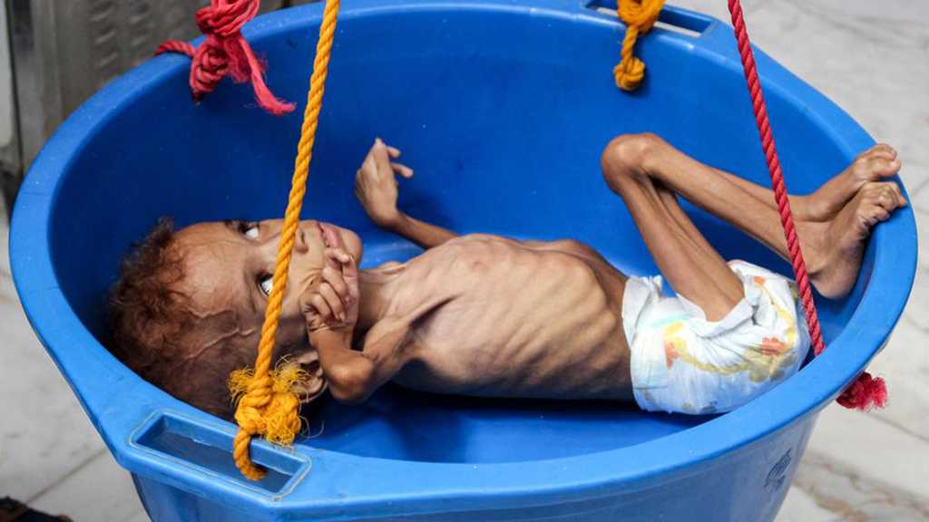 Yemen Could Face Brink of Famine Again – UN Warns