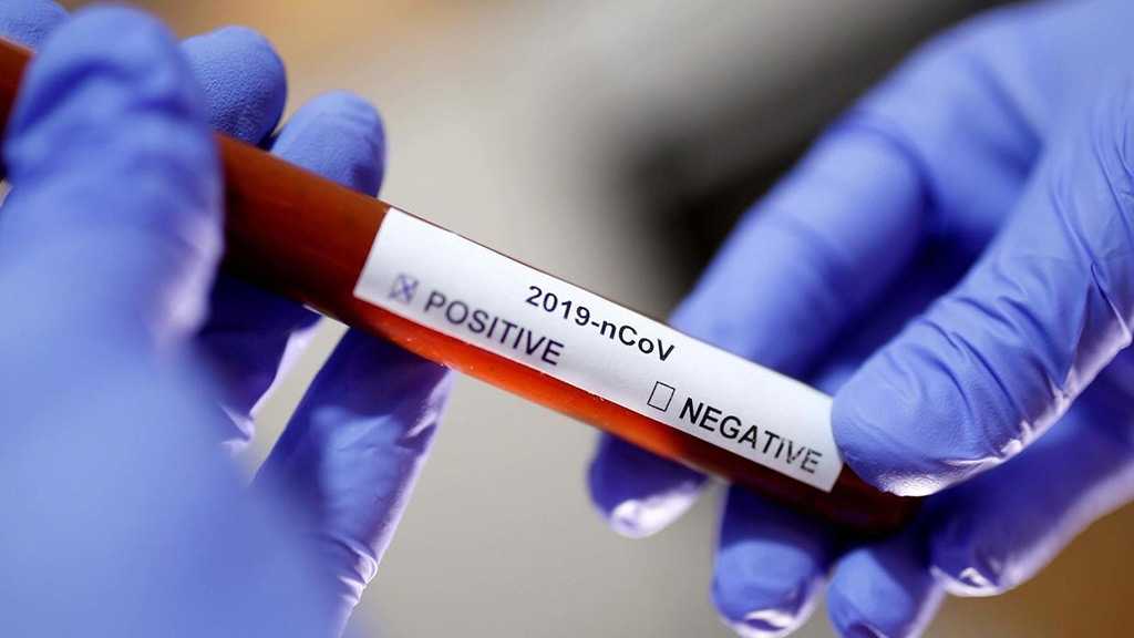 Two US Lawmakers Self-Quarantine Over Contact with Virus