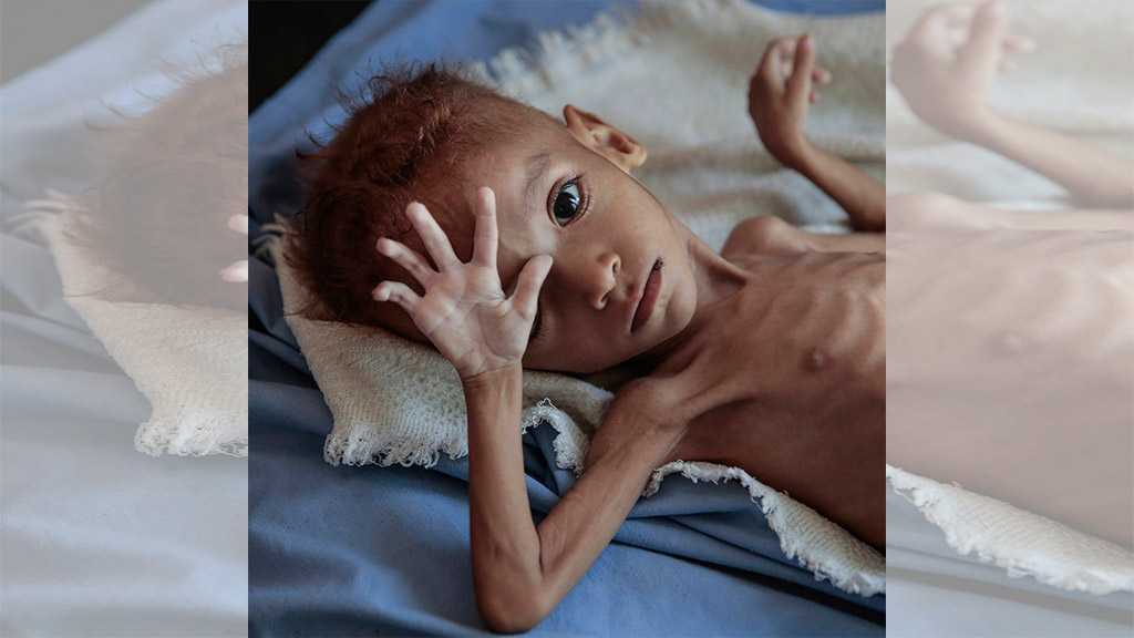 Yemen War Kills 50,000 Children Every Year