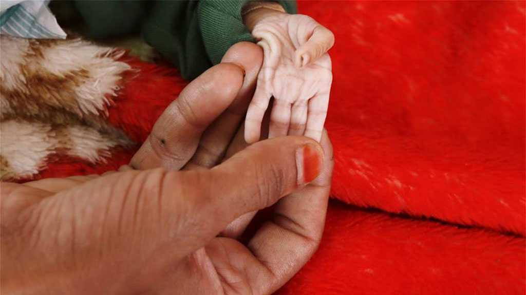 Yemen’s Children Suffer From Lack Of Medicine, Aid Cut