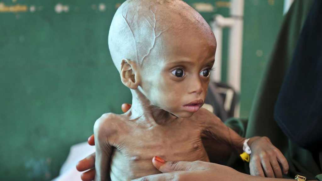 Children Injected with Expired Vaccines in Occupied Yemeni Areas