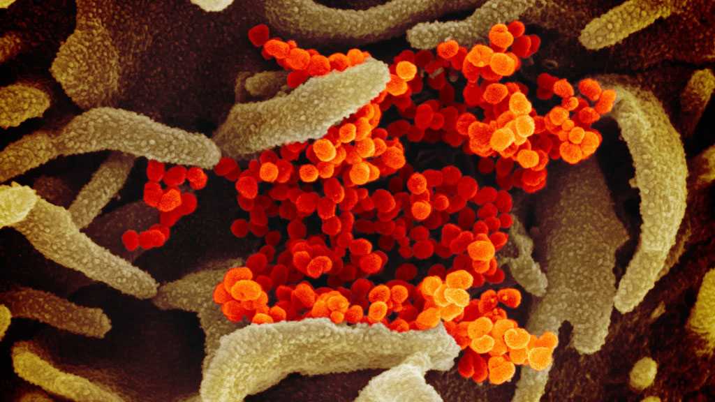 Human Protein Found to Make Coronavirus Highly Infectious