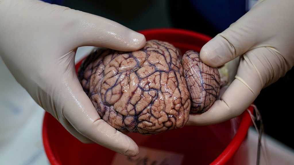 COVID’s Cognitive Costs? Some Patients’ Brains May Age 10 Years