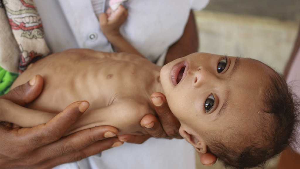 Yemen on the Verge of Famine - UN
