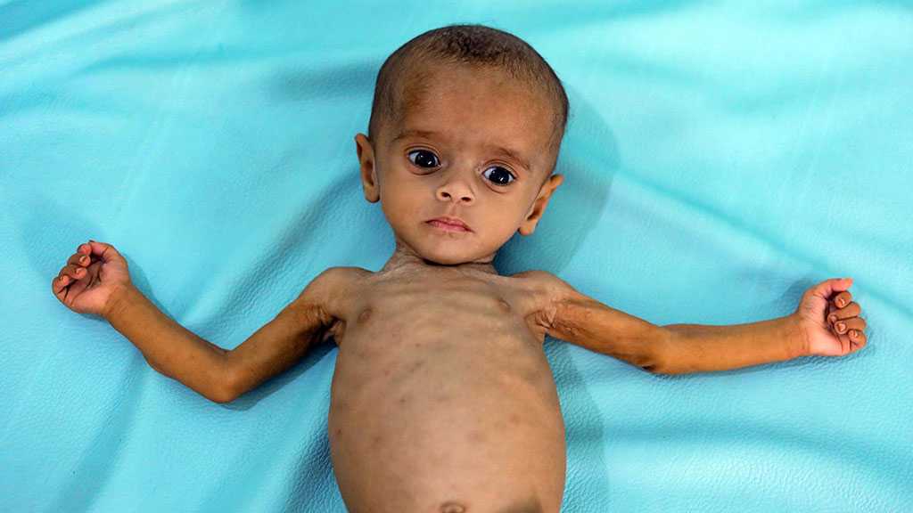 UN Chief Warns Yemen in Imminent Danger of Famine