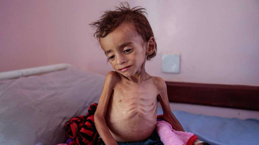 Yemen Can’t Wait: Almost Half of Population Experiencing High Levels of Food Insecurity