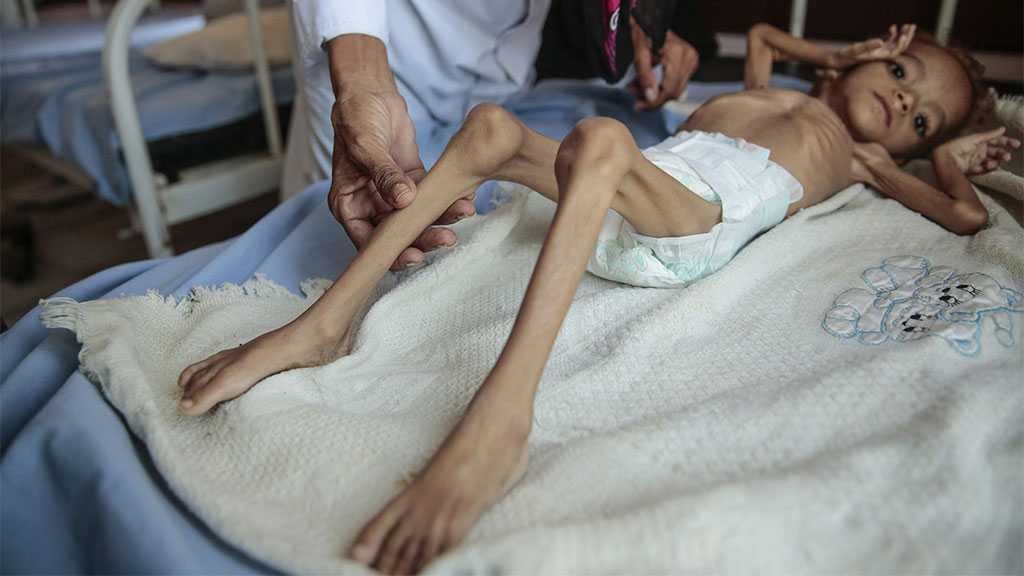 Over 16 Million People in Yemen to Go Hungry This Year - UN
