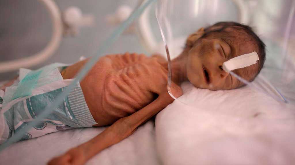 ‘Too Much Concerned’ UN Finally Says ‘It Is Hell in Yemen’!