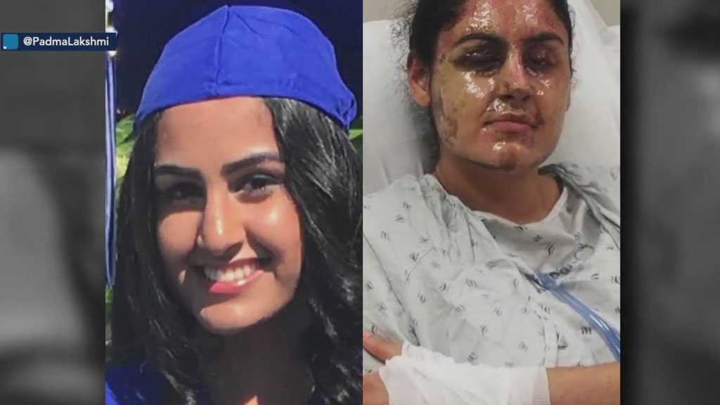 US Hate Crimes: Muslim Woman Burned in Acid Attack in New York