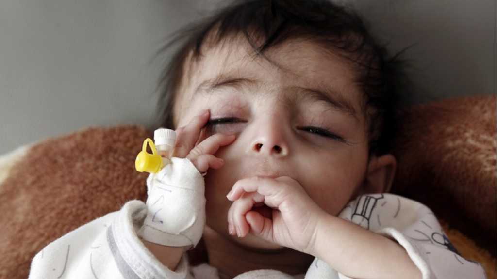 Yemen’s Famine Crisis On ’Highest Alert’ - UN