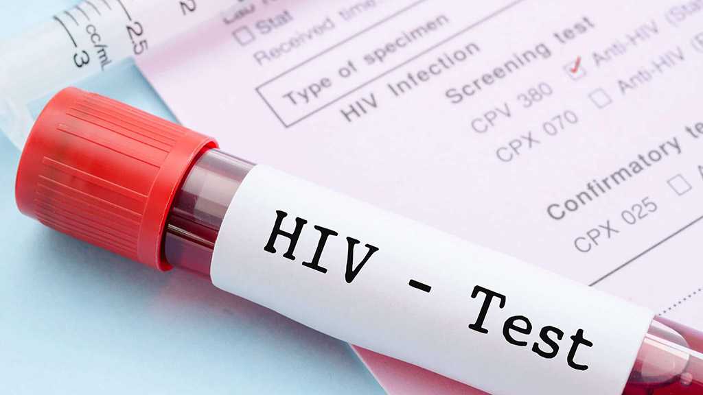 New “Highly Virulent” HIV Strain Discovered in The Netherlands