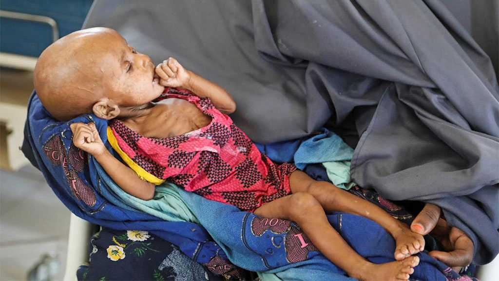 350k Somali Children Facing Starvation - UN