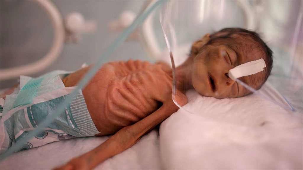 UN: Over 19 Million Yemenis Facing Hunger
