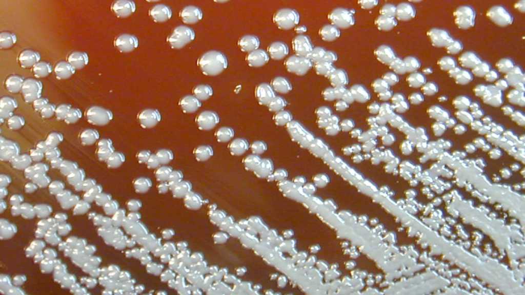 Bacterium Leading to Deadly Infections Unprecedentedly Found in US Soil, Water
