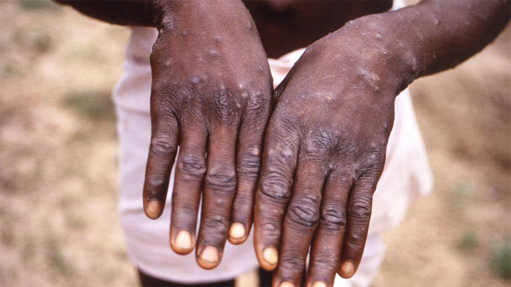 WHO Calls Urgent Meeting On Killer Virus