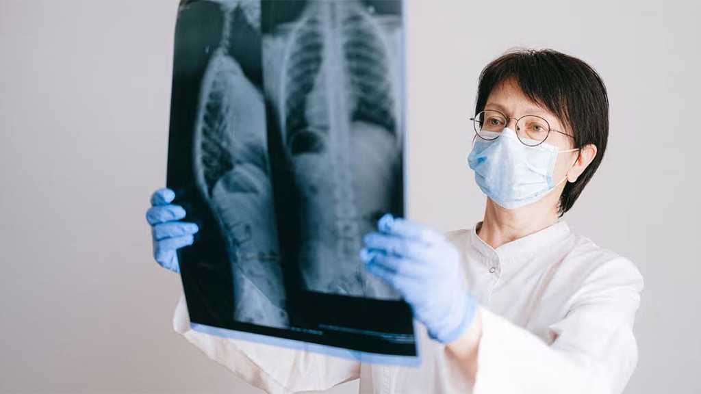 Lung Cancer Pill Cuts Risk of Death by Half - Study