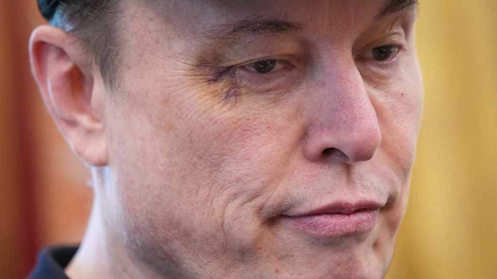Elon Musk Says Black Eye Came from Son, Jokes He Was “Nowhere Near France”