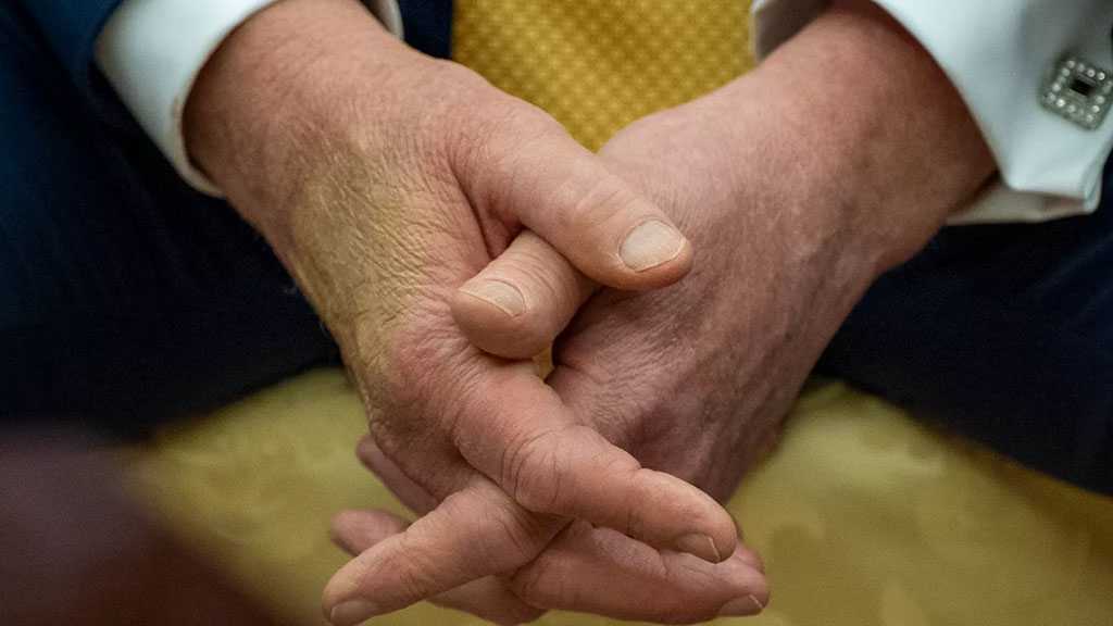 Trump Diagnosed with Common Circulatory Condition After Leg Swelling Exam